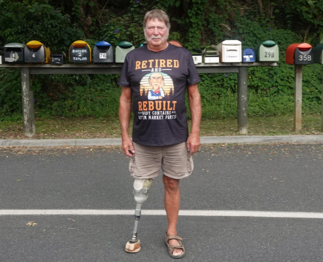 Someone has stolen Russel Blank's foot and he is, to put it politely, "pissed off" about it....