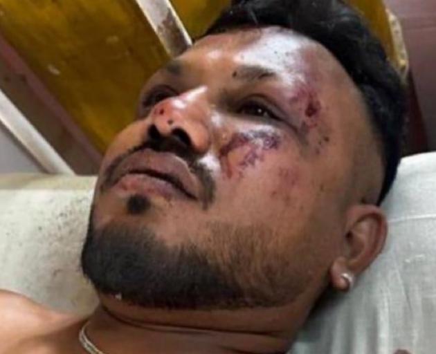 Crash survivor Ramesh Viswashkumar. Photo: Twitter