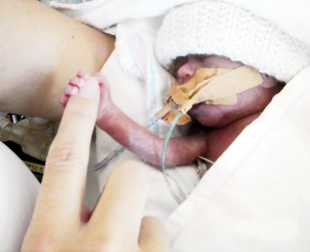 Phoebe Finlay holds her mother Katrina’s finger, shortly after birth at Dunedin Hospital. PHOTO:...