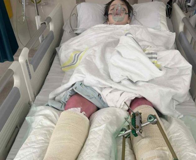 Oamaru boy and keen skiier Charlie Lane was seriously injured after an 8m fall while skiing....