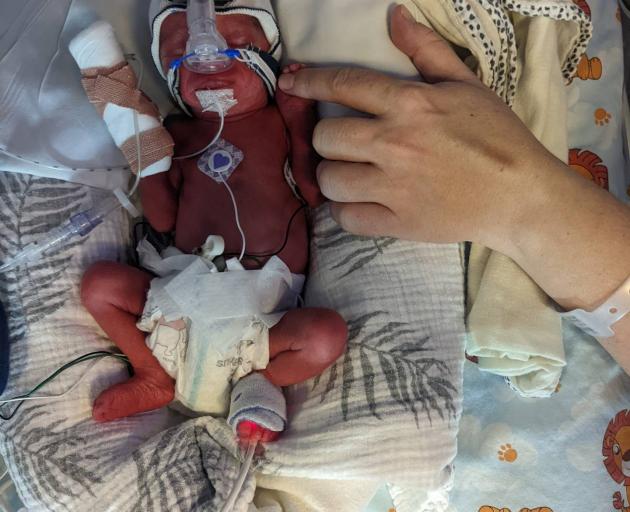 Esther is the smallest of the quadruplets, weighing in at 1.024kg. Photo: Supplied