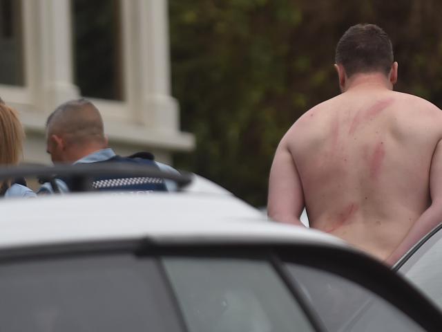 Police lead a handcuffed shirtless man away from the scene.