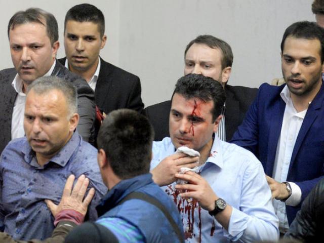 An injured leader of the Social Democrats Zoran Zaev is escorted out of the parliament in Skopje. Photo: Reuters