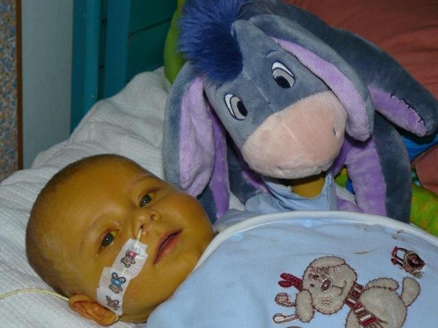 As a baby, Hamish became the youngest New Zealander to receive a  liver transplant. 
