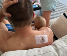 Richie McCaw was straight back into parenting duties despite his injuries. Photo / Instagram, ...