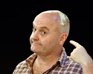 Actor Phil Vaughan shows off his injury at the Fortune Theatre yesterday. Photo by Peter McIntosh.