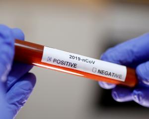 Test tube with coronavirus name label is seen in this illustration picture. Photo: Reuters