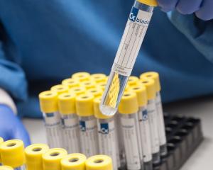 Cxbladder test samples produced by Pacific Edge. PHOTO: ODT FILES