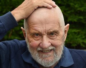 Dunedin man Dai Redshaw holds his bald head while displaying a photo of himself before his big...