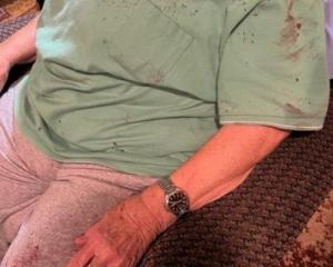Susan Johnston’s mother was left feeling "shaken" after her daughter attacked her with a wine...