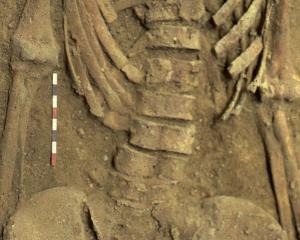 The last meal of this woman, who lived about 4000 years ago, can be seen in her pelvis. Photo:...