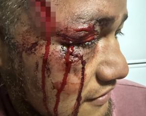 Green Island prop Aifala Taelega has been left with a nasty wound after he was stomped in the...