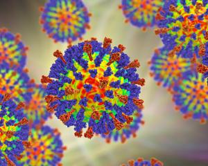 Measles is highly contagious, and can have serious long-term health consequences. File photo:...