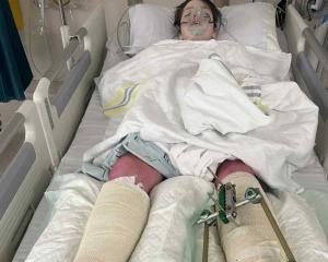 Charlie Lane, of Oamaru, was seriously injured in an 8m fall while skiing. Photo: supplied