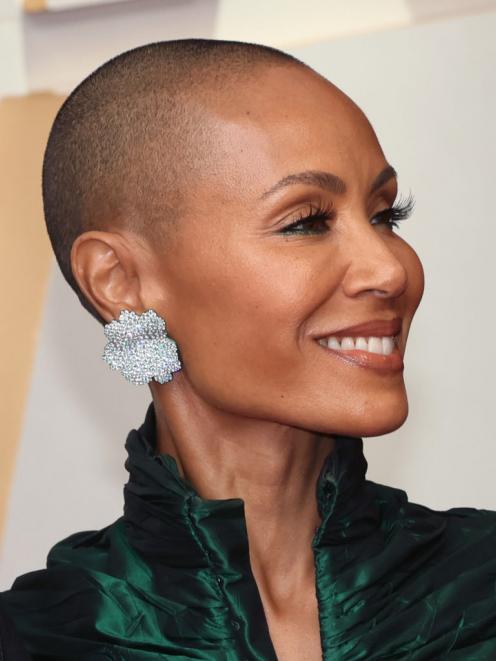 Jada Pinkett Smith suffers from alopecia, a condition that causes hair loss. Photo: Getty Images 