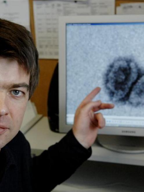 University of Otago scientist Dr Alexander McLellan points to images -- magnified a million-fold ...