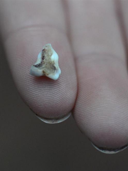 A Dunedin woman got more than potato chips in her bag of potato crisps  - she also got a tooth...