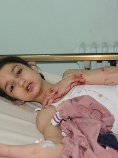 A girl who was injured in a car bomb that exploded in Daf al-Shok district lies in a hospital in...