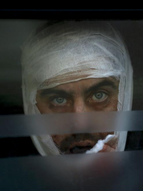 A wounded Ukrainian soldier looks through a windows as he arrives to a hospital in Artemivsk....