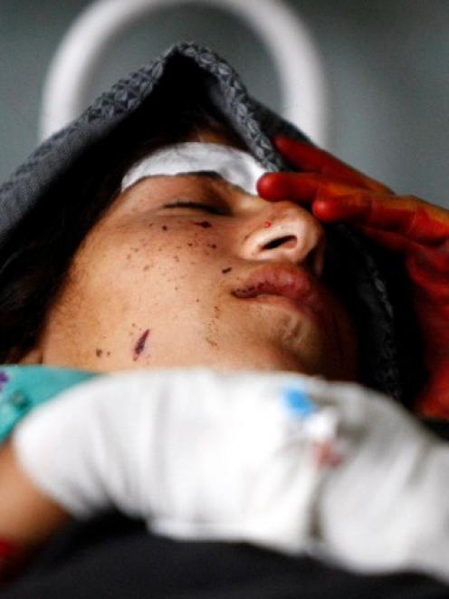 A wounded woman rests at a hospital after NATO air strikes in Laghman province, Afghanistan....