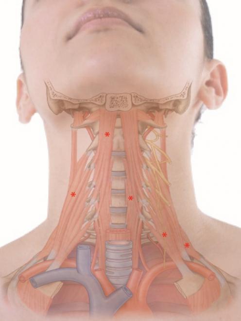 Anterior neck muscles (modified from Drake RL et al: Gray's Anatomy for Students ©Elsevier 2010)