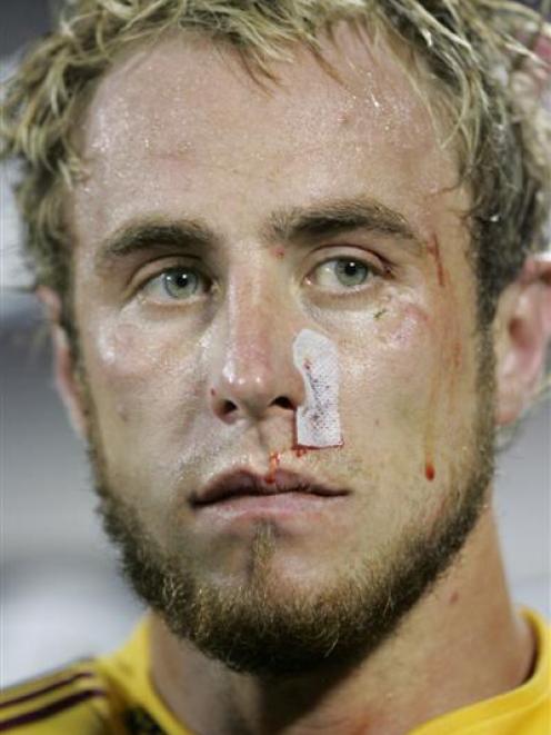 Battered Highlanders captain Jimmy Cowan after defeat by the Crusaders in the Super 14 Rugby...