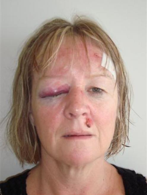 Clare Holden shows her facial injuries. Photo supplied.