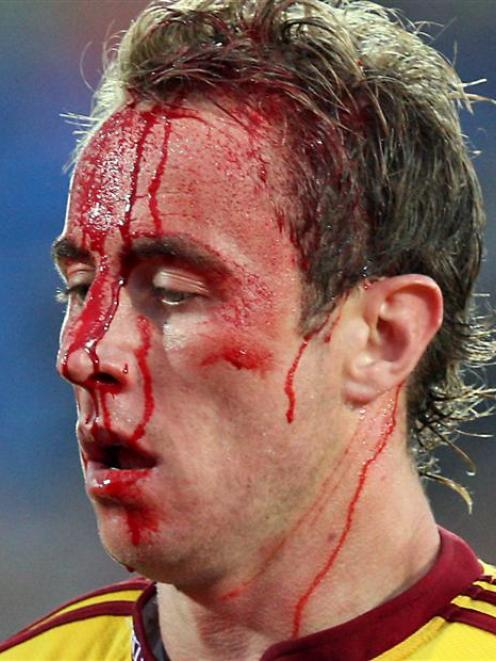 Highlanders halfback Jimmy Cowan leaves the field injured against the Crusaders. He later...
