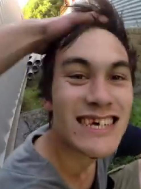 Matt Quinlan of Auckland immediately after he fell while attempting a Parkour stunt. The video of...