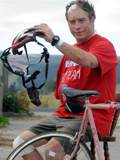 Outram cyclist John Nicholl with the remains of his bicycle and helmet yesterday after he was hit...