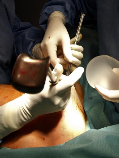 Plastic surgeon Denis Boucq (R) holds a new silicone gel breast implant used to replace a...