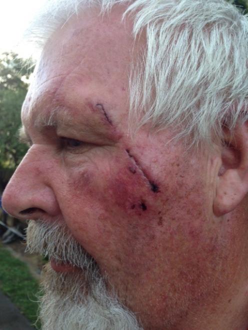 Senior Constable Chris Barclay was attacked by a pitbull while on duty. Supplied photo.