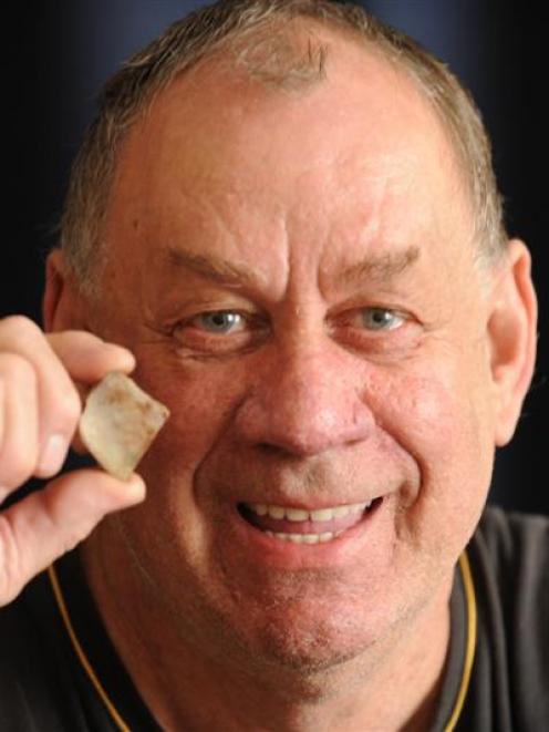 St Kilda resident Conway Wood and the piece of bone removed from his throat. Photo by Stephen...