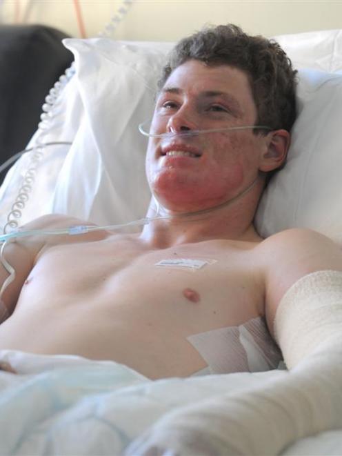 Telford Rural Polytechnic student Matthew Scally (18) recovers in Dunedin Hospital after landing...