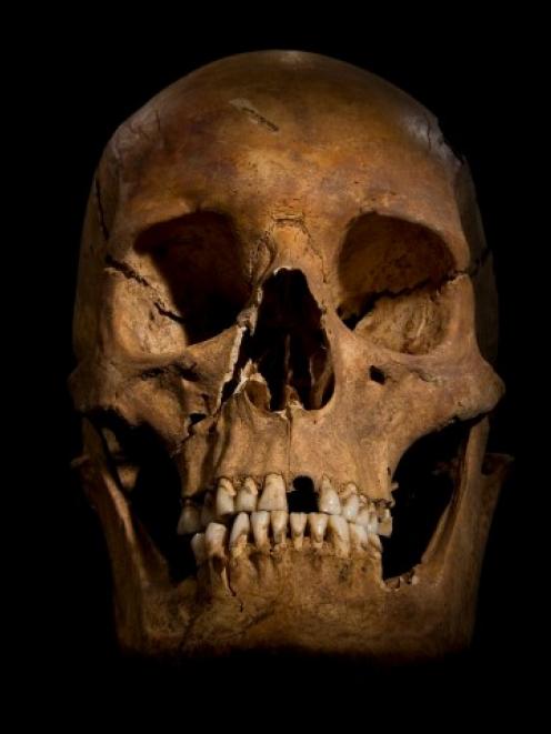This skull, which archaeologists say belongs to Richard III, is part of a skeleton found under a...