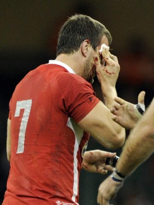 Wales' captain Sam Warburton leaves the field with a blood injury during the test against...