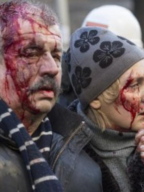 Wounded people are seen after clashes with riot police in central Kiev. REUTERS//Vlad Sodel