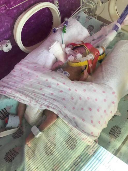 Baby Ruby remains on a ventilator.