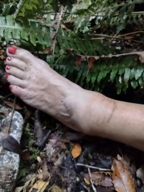 Vanessa Bridge’s ankle after her fall on the Dusky Track. PHOTO: SUPPLIED