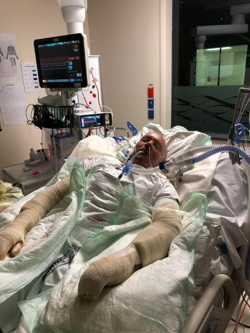 Kevin Burney faces a long road to recovery at Middlemore Hospital after a metal drum exploded...