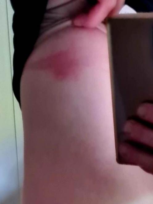 A Lincoln woman was stung while mowing her lawn. Photo: Supplied