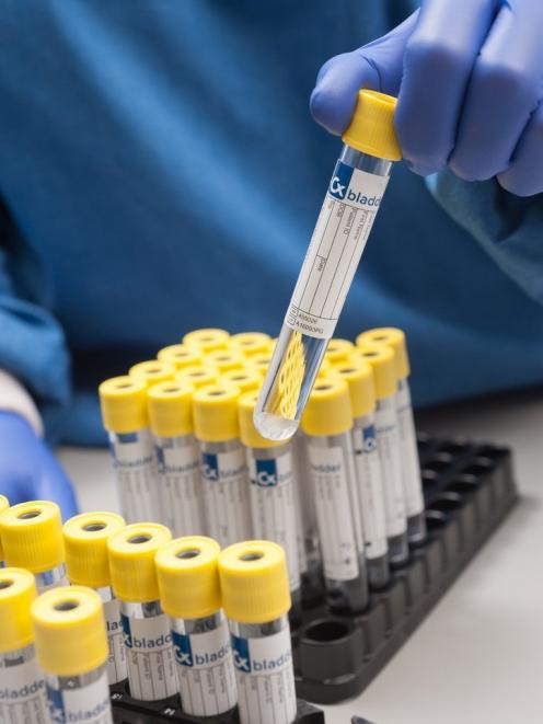 Cxbladder test samples. PHOTO: SUPPLIED