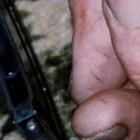 An evidence photo of Robin Bain's hand showing marks on his thumb which the TV3 documentary said...