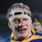 Eben Joubert shows the signs of a torrid encounter against Bay of Plenty at Carisbrook on...