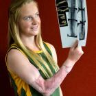 Olivia with some of the X-rays and MRI scans taken after she was run over by a truck and trailer...
