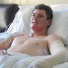 Telford Rural Polytechnic student Matthew Scally (18) recovers in Dunedin Hospital after landing...
