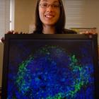 University of Otago doctoral researcher Sarah Saunderson displays a section of spleen magnified...