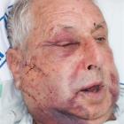 War veteran and assault victim Eric Brady. Credit:NZPA / NZ Police