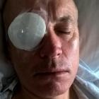 Dunedin man Wayne Boss' eye was seriously injured during the fireworks display in the Octagon....