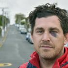 After moving back to Dunedin last year, Jared never thought he would be the victim of a violent...